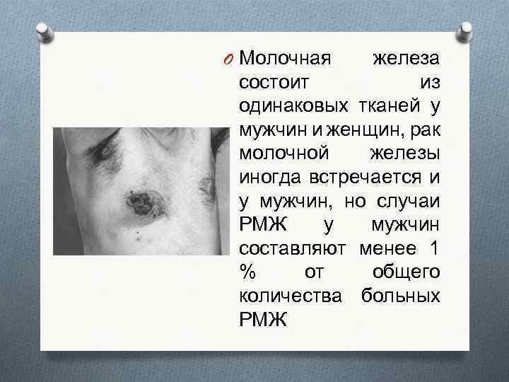 Жизнь после рака молочной железы