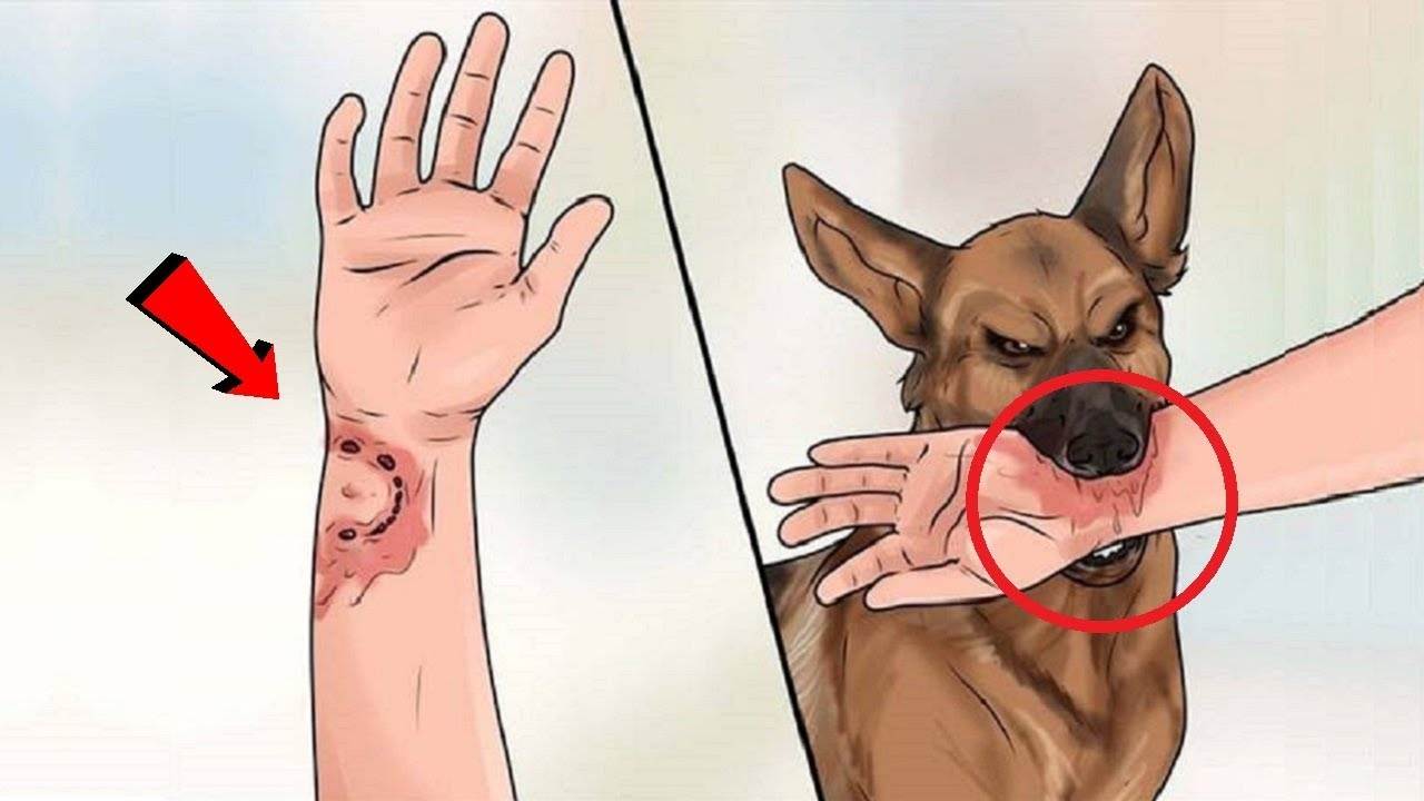 Если укусила домашняя собака до крови что делать | симптомы и признаки, первая помошь, лечение от бешенства, штрафы в беларуси