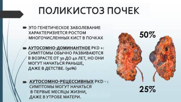 Поликистоз почек у кошек и котов