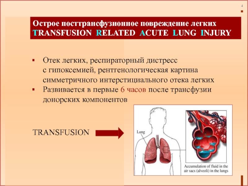 Отёк лёгких у кошек: причины, симптомы и диагностика, лечение
