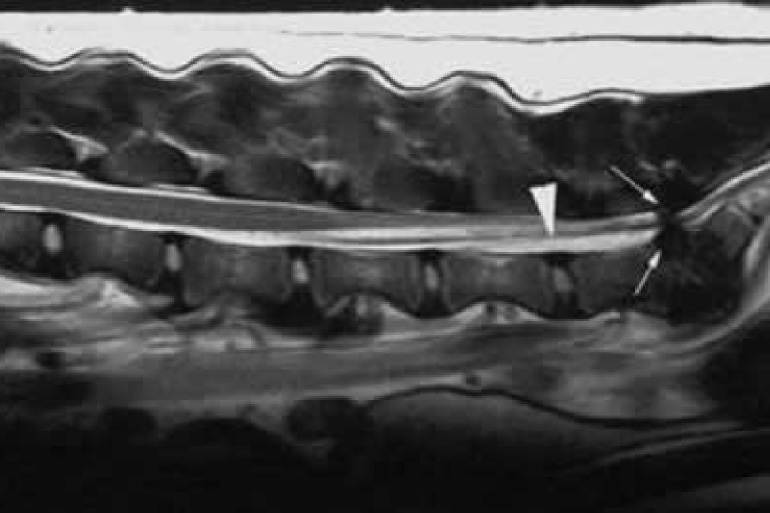 Синдром конского хвоста у собаки. Пояснично-крестцовый стеноз у собак. Синдром кауда эквина у собак. Синдром конского хвоста на рентгене.