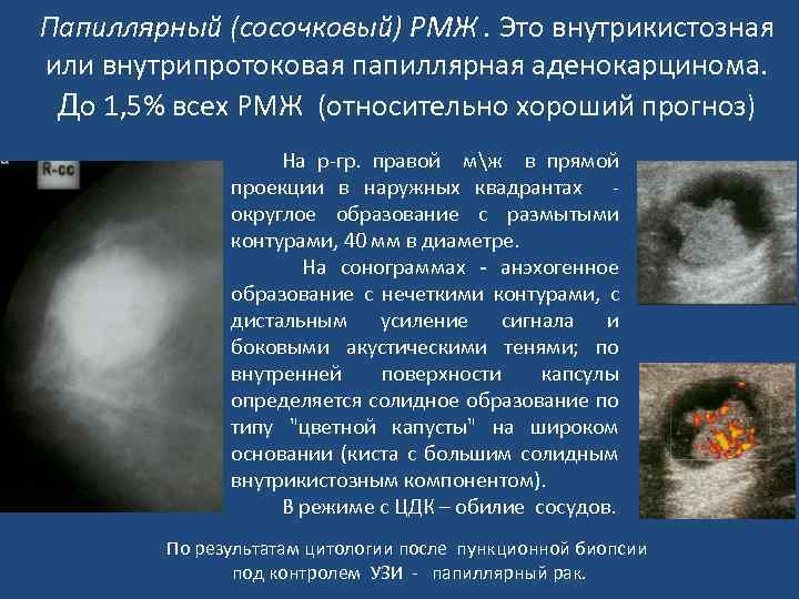 Опухоль молочной железы у кошки: виды, причины, диагностика