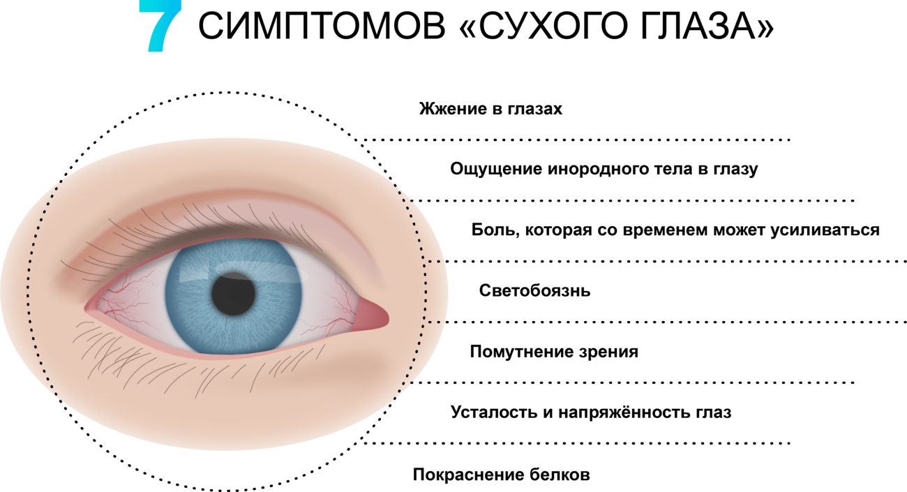 Сухой глаз симптомы капли. Причины развития синдрома сухого глаза. ССГ (синдром сухого глаза. Синдром сухого глаза профилактика. Причины возникновения синдрома сухого глаза.