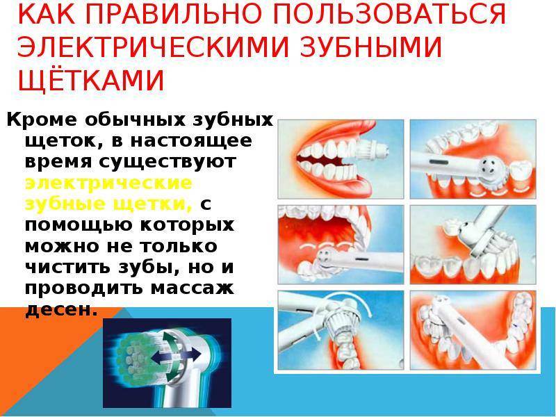 Можно ли чистить зубы ребенку. Правильная методика чистки зубов зубной щёткой. Метод чистки зубов электрической щетки. Как чистить зубы электрической щеткой. Правило чистки зубов электрической щеткой.