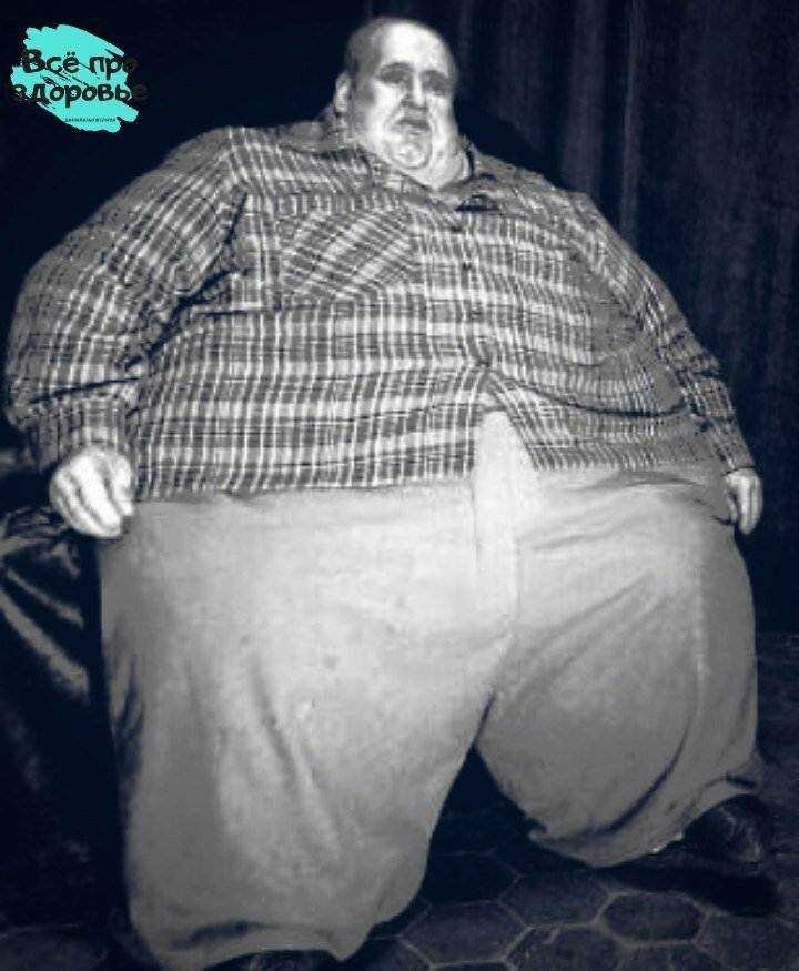 Сильно толстый человек
