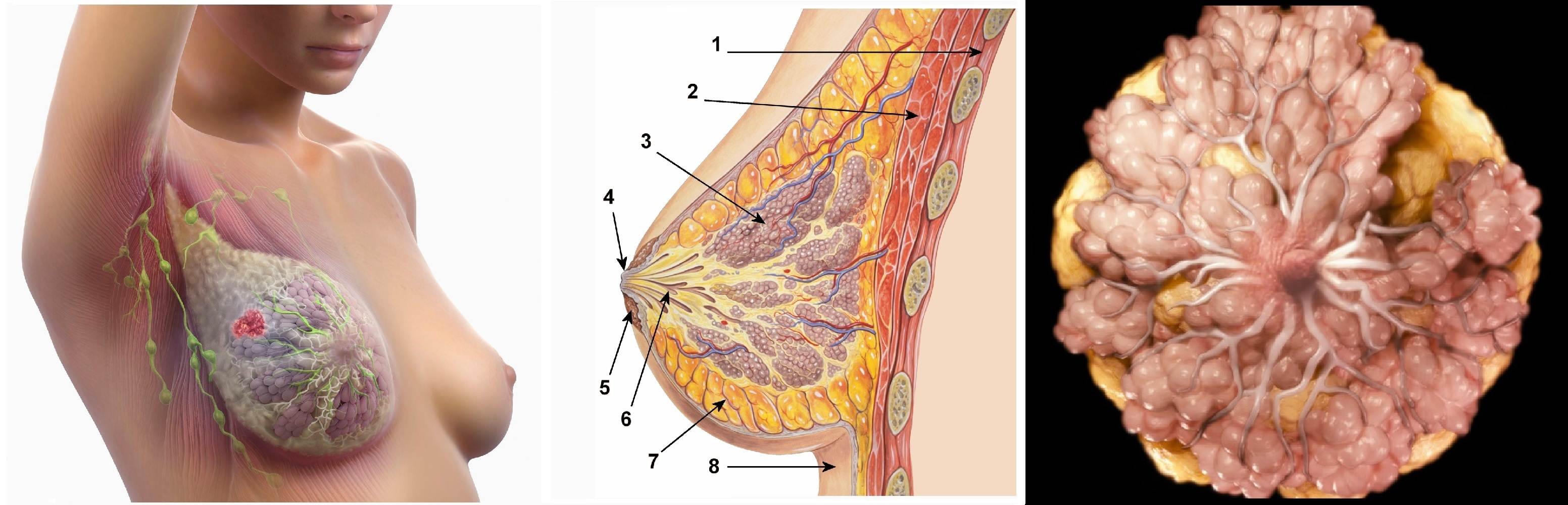 Как отличить боли при мастопатии и раке молочной железы