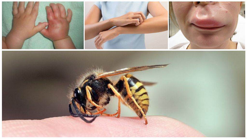 Что делать, если собаку или щенка ужалила пчела: симптомы и первая помощь