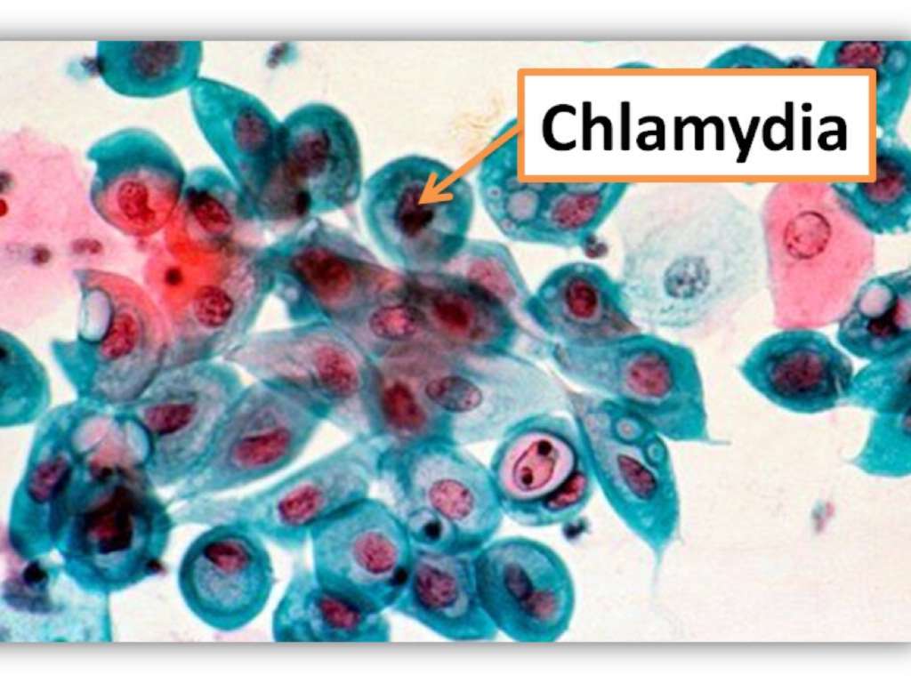 Хламидия trachomatis. Хламидии микробиология. Хламидии под микроскопом. Хламидии рисунок микробиология. Хламидии препарат микробиология.